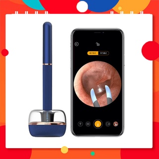 Dụng cụ vệ sinh tai thông minh tích hợp ống nội soi Xiaomi Bebird Note 3 Note3 Pro