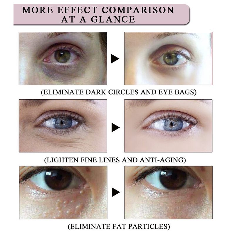 Hộp 30 Viên Kem Dưỡng Da Mắt Chống Nếp Nhăn Lão Hóa Loại Bỏ Quầng Thâm