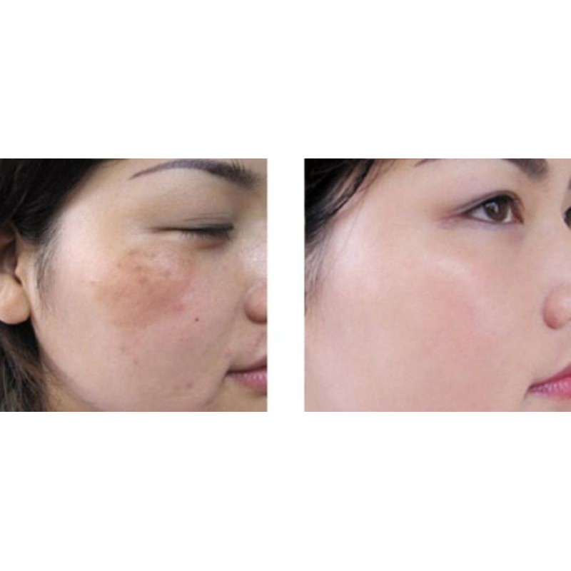 Kem Chống Nắng Hoàng Cung Hồng Chính Hãng Danxuenilan - Trang Điểm Ban Ngày