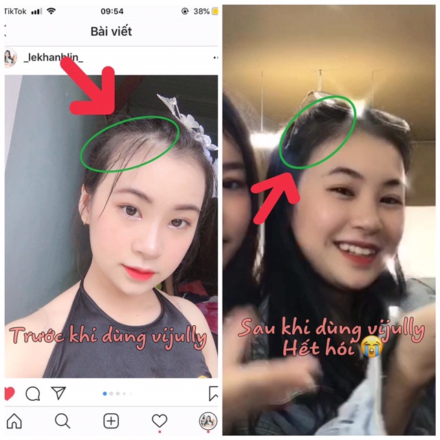 Tinh Dầu Bưởi ViJully Siêu Mọc Tóc 100ml | BigBuy360 - bigbuy360.vn