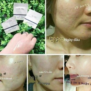 Combo 10 gói Tinh Chất Vàng Ohui The First Ampoule Advanced