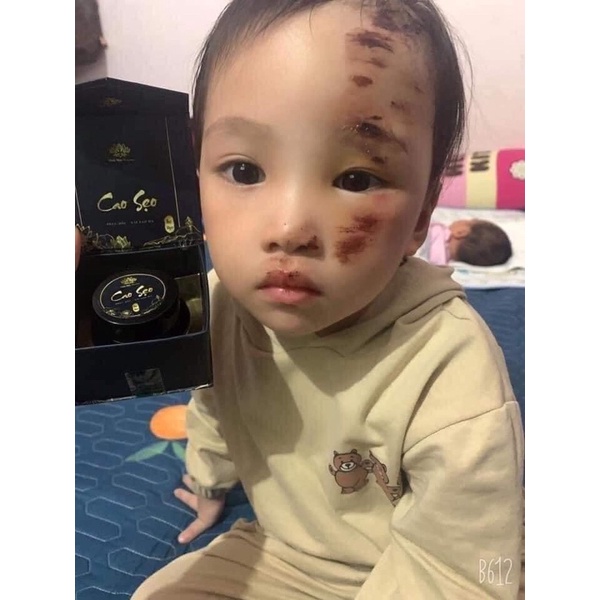 CAO SẸO BẠCH LINH -BÁCH Y SÂM -NHẤT MỘC HƯƠNG | BigBuy360 - bigbuy360.vn