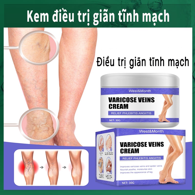 Kem giãn tĩnh mạch