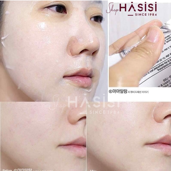 [Chính hãng] Mặt nạ BNBG Vita Genic Jelly Mask