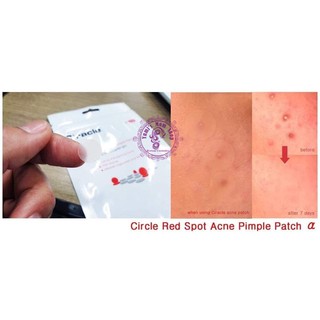 Miếng Dán Mụn Ciracle Red Spot Acne Pimple Patch