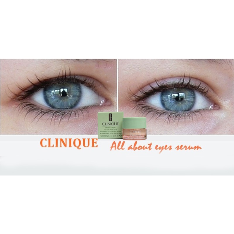 Kem dưỡng mắt Clinique All About Eyes 5ml nắp xanh