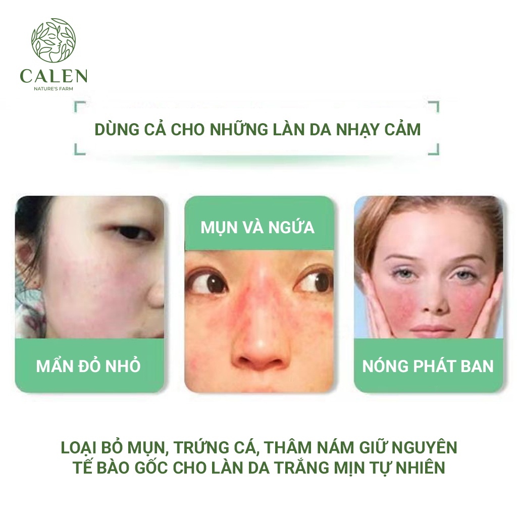 Serum giảm mụn thâm rỗ Calen -Skin 7 Days se khít lỗ chân lông giúp da sáng mịn,công dụng 5 in 1 hiệu quả sau 7 ngày