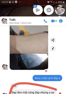 Combo trị da rắn và viêm chân lông