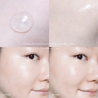 Kem dưỡng ẩm Clinique Jelly Dramatically Different Moisturizing