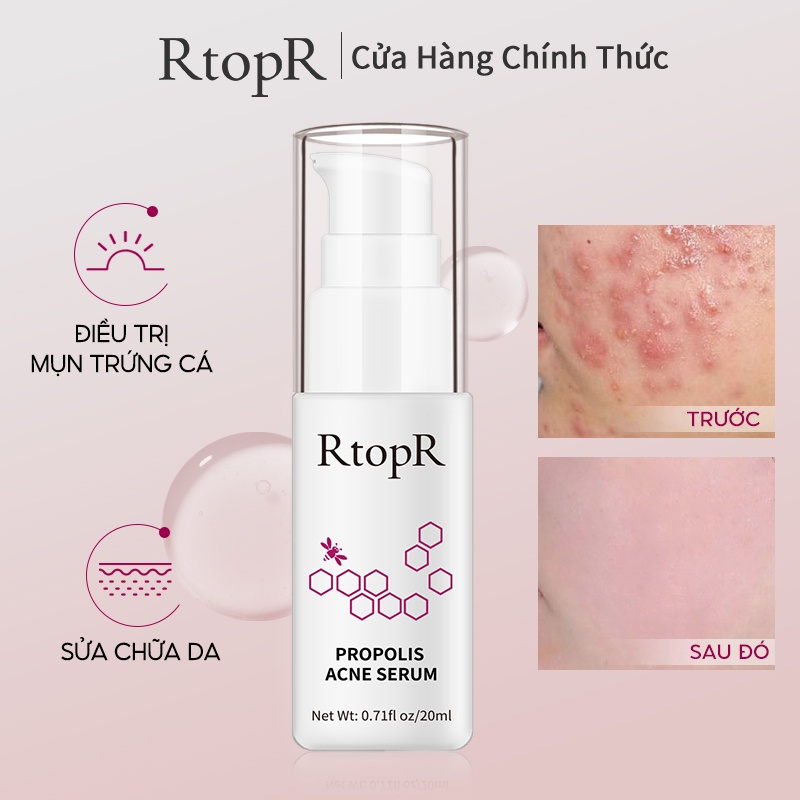 Serum hỗ trợ trị Mụn Trứng RtopR 20ml Giảm Vết Thâm Thu Nhỏ Lỗ Chân Lông Tăng Cường Và Phục Hồi Sâu