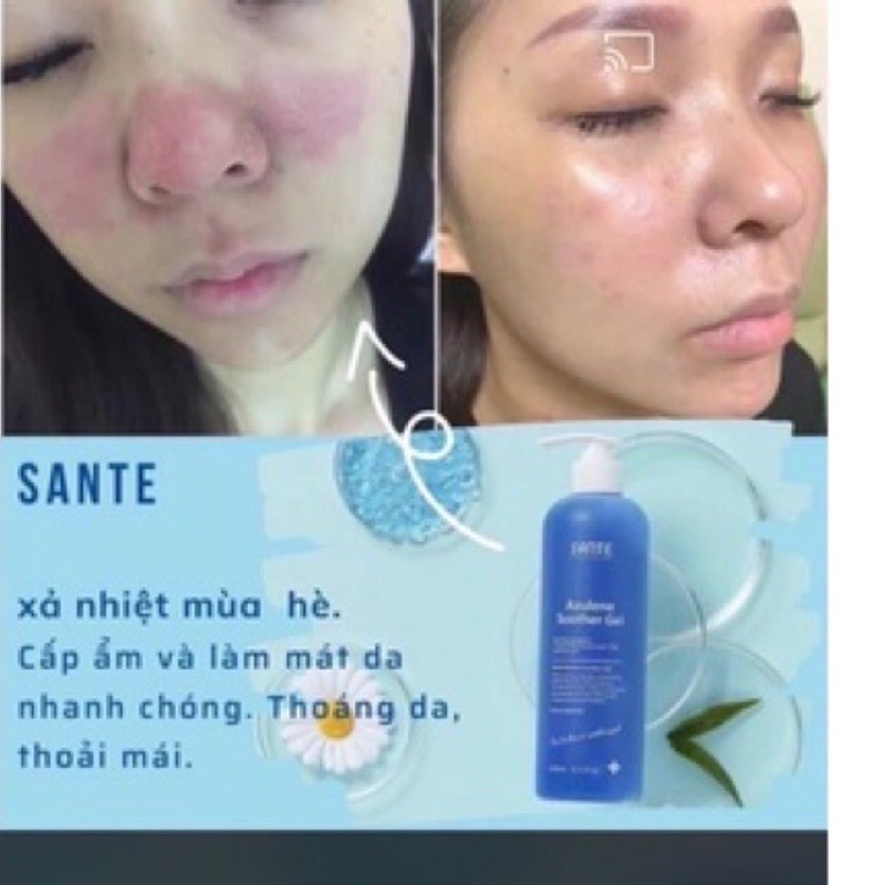 Gel Sante Làm Dịu Phục Hồi Da Tổn Thương - Mỏng Yếu Fullsize 500ml