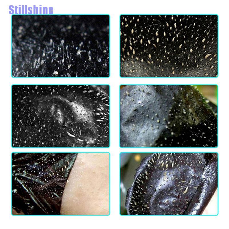 Set 10 Mặt Nạ Lột Mụn Đầu Đen Làm Sạch Sâu Vùng Mũi