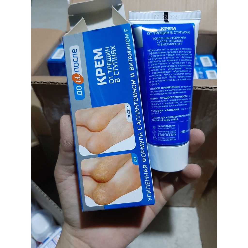 Kem Trị Nứt Nẻ Gót Chân Kpem Nga 50ml