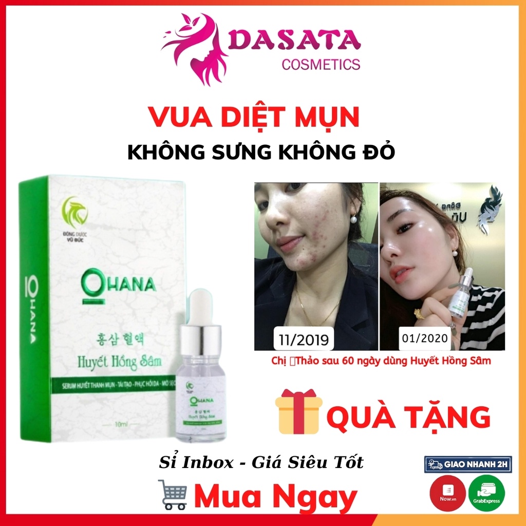 Huyết Hồng Sâm OHANA Sạch Mụn Thâm Sẹo Rỗ Không Sưng Không Đỏ Hiệu Quả Ngay Lọ Đầu Tiên DASATA