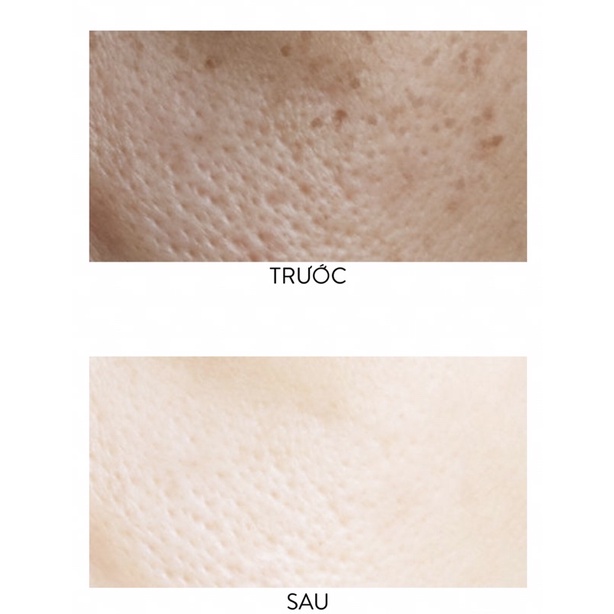 Mona Frema 7% MPA+ Serum Tái Tạo Da