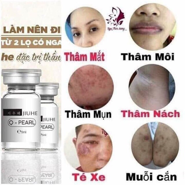 Serum mờ thâm juihe hàng chuẩn [ kèm team điện tử ]