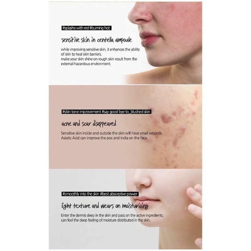 Serum Rau Má Hỗ Trợ Giảm Mụn,Cấp ẩm  Phục Hồi Da Skin1004 Madagascar Centella Ampoule