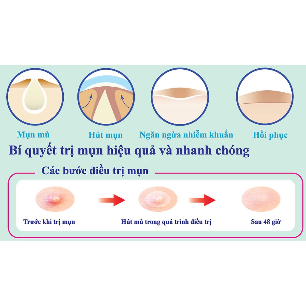 Miếng dán mụn, miếng hút mụn Somaderm 3 size Hộp 24 miếng