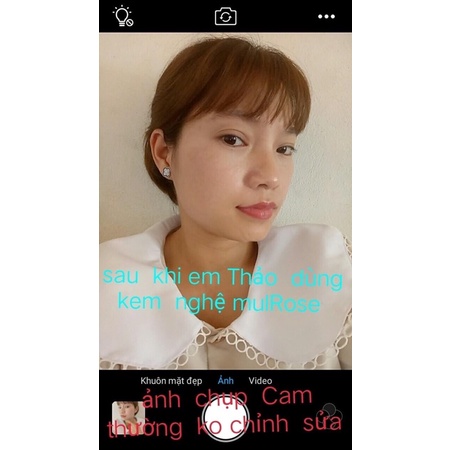 [Chính hãng] Kem nghệ đa năng Mulrose ngừa mụn đẹp da mờ sẹo