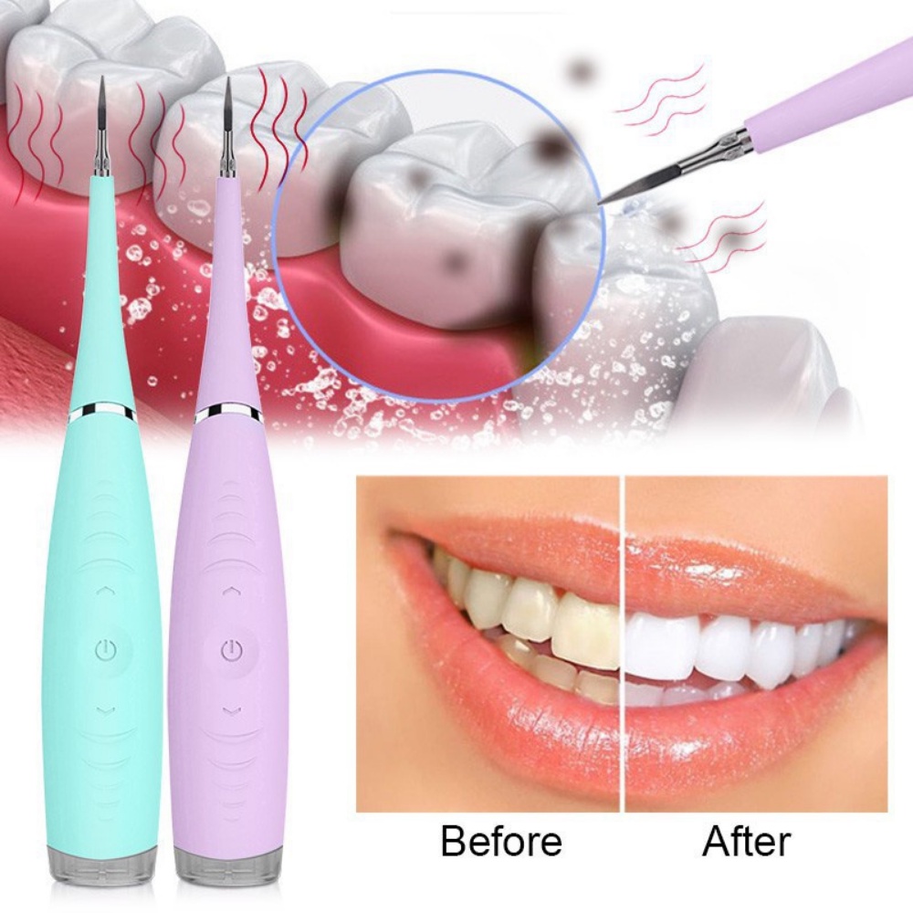 Máy Lấy Cao Răng Tại Nhà Dental - Sạc pin 3 Chế Độ Rung Loại Sạch Mảng Bám, Cao Răng,Vết Ố Cứng Đầu Nhất - BH 2 năm