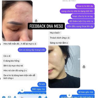 [Siêu Đỉnh] Set Dưỡng Da DNA Tươi