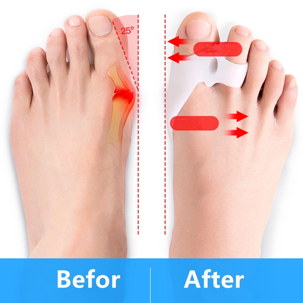 Dụng Cụ Tách Ngón Chân Bằng Silicone Co Giãn Thoáng Khí Chống Mài Mòn