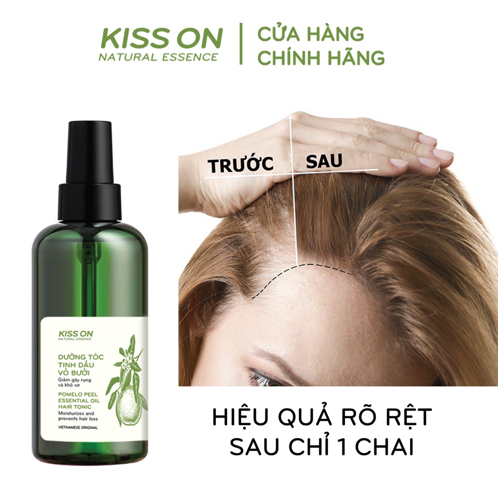 Xịt mọc tóc tinh dầu vỏ bưởi KISS ON 145 ml - Ngăn ngừa rụng tóc, kích mọc tóc, cung cấp dưỡng chất c