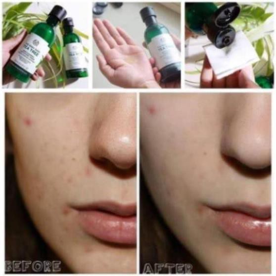 ✅✅ (HÀNG CHUẨN NỘI ĐỊA EU) ữa rửa mặt Da Dầu Mụn The Body Shop Tea Tree Skin Clearing Mattifying Toner