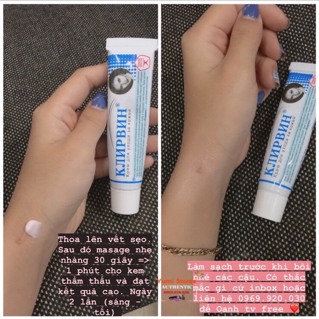 Kem cải thiện sẹo Nga Klirvin