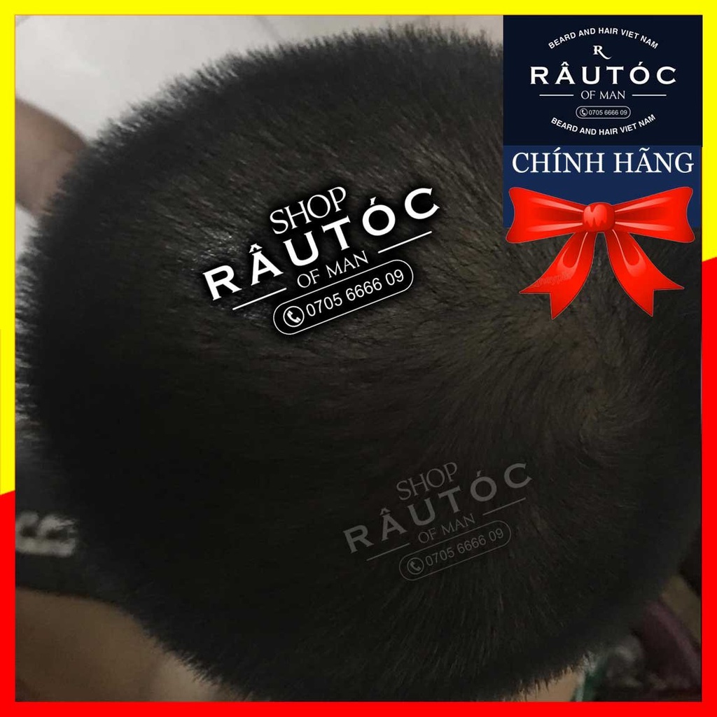 Mọc tóc Hair 4U Pro