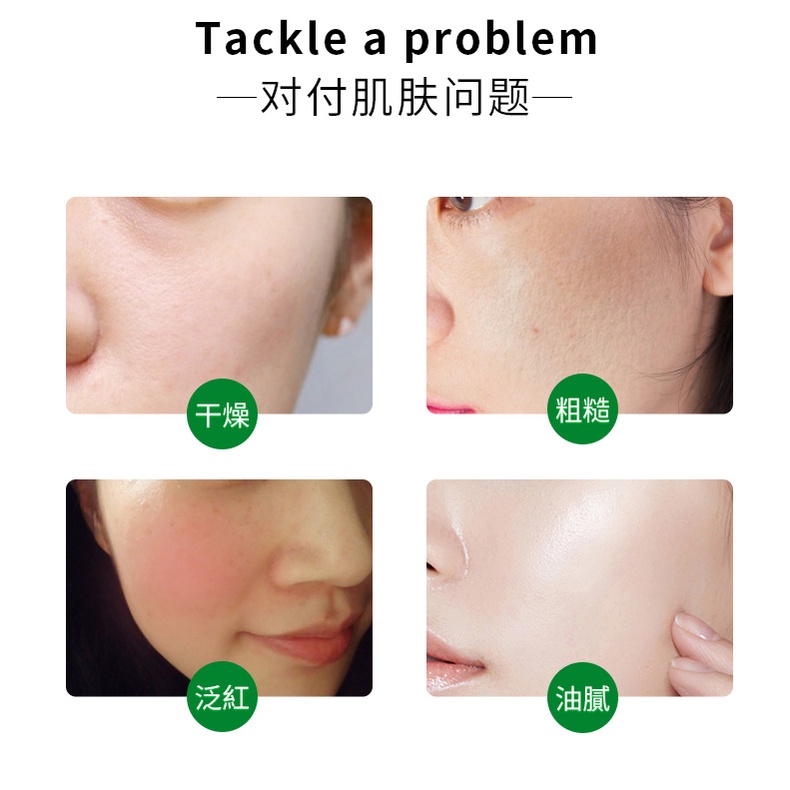 Gel lô hội dưỡng ẩm se khít lỗ chân lông làm dịu da MAIGOOLE
