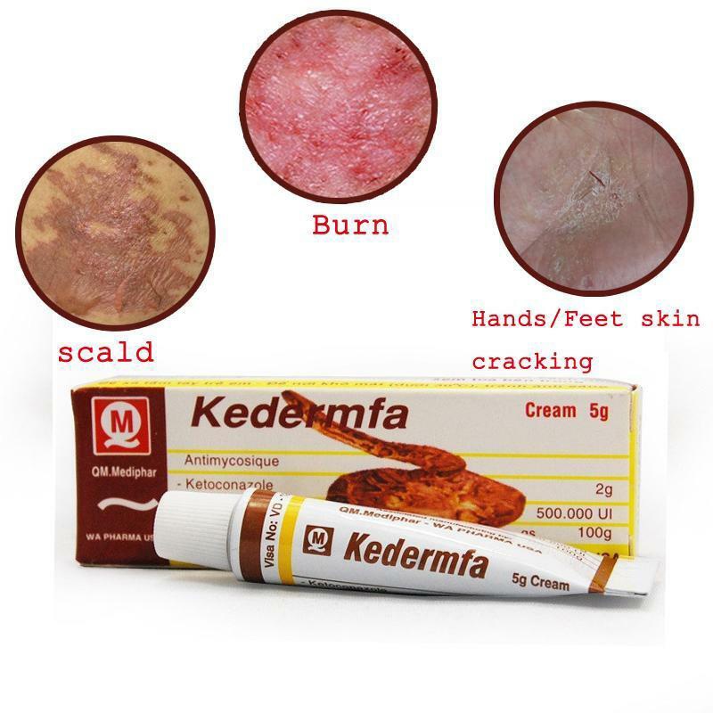 （In stock） Burn Scald Ointment Remove Rot Muscle Anti-infection Promotes Skin Healing Snake Oil Burn Ointment Skin Care5g Vietnam Kedermfa Pure Snake Ointment For Burn Scald Skin Cracking Eczema uniq