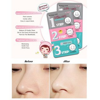 Bộ mặt nạ BIOAQUA lột mụn mũi 3 bước