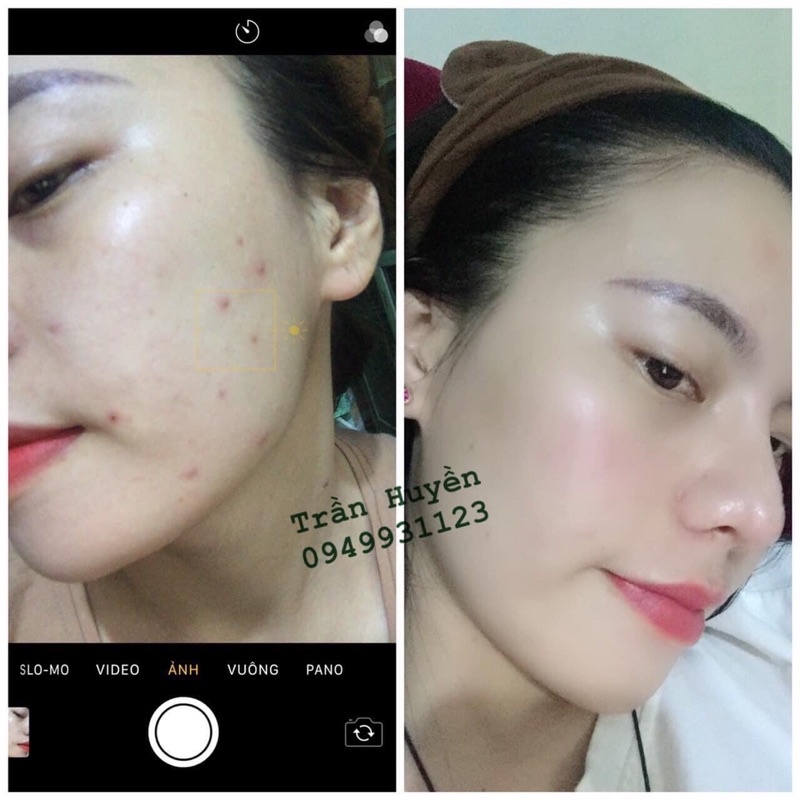 [Chính Hãng] Vaurora | BigBuy360 - bigbuy360.vn