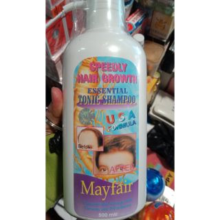 Thuốc kích mọc tóc Thái Lan