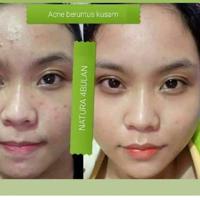 ! Tấm trải giường phun sương làm đẹp mã-288 Natura thế giới 10 | BigBuy360 - bigbuy360.vn