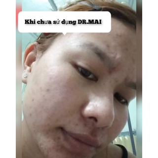 DRMAI MIX SAFFRON CHUYÊN MỜ THÂM