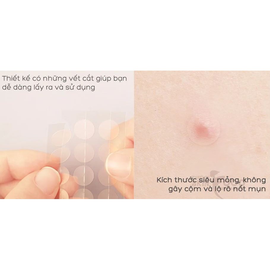 Miếng Dán Mụn Hatherine Spot Care Patch | BigBuy360 - bigbuy360.vn