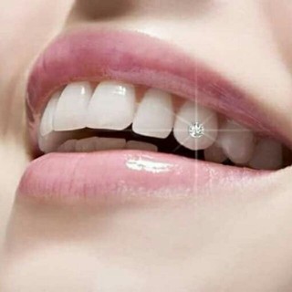 (giá sập sàn)Đá đính răng 20v tặng kèm keo bút gắn  ZIPPER