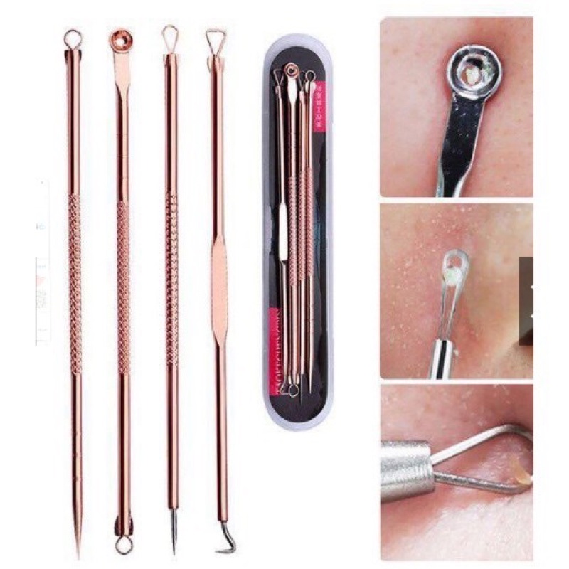 Bộ 4 Cây Nặn Mụn Chuyên Nghiệp 8 Đầu Nặn Siêu Phẩm Que Nặn Mụn