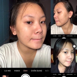 SERUM GIẢM MỤN THÂM VAURORA