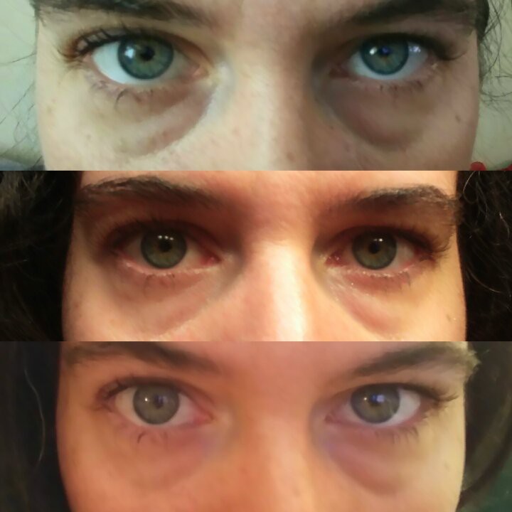 Serum giảm quầng thâm và bọng mắt The Ordinary Caffein Solution 5% + EGCG 30ml