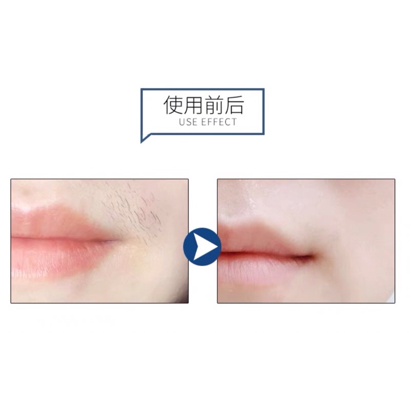 KEM TẨY LÔNG MẶT VÀ BODY NAIR