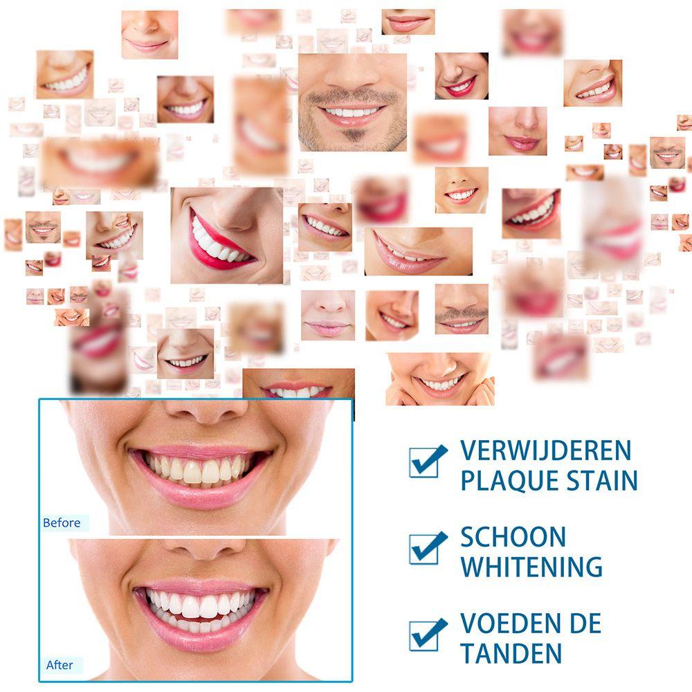Nước Tẩy Trắng Răng Tức Thì EBINLANDS 5ml