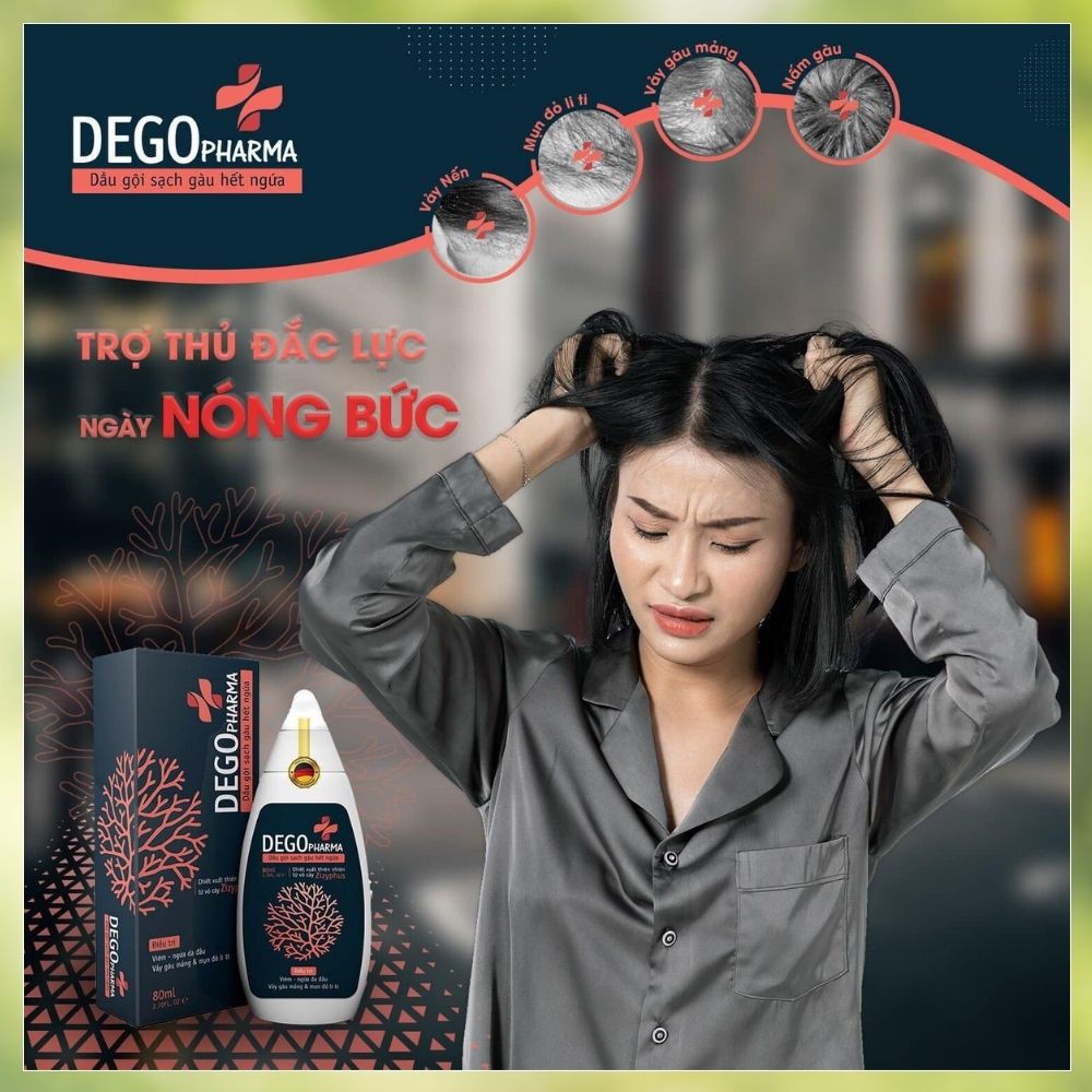 [CỰC HOT] Dầu gội đầu gàu,Nấm da đầu ,Diệt nấm gây gàu chấm dứt cảm giác ngứa Chiết xuất thiên nhiên từ vỏ cây Zizyphus | BigBuy360 - bigbuy360.vn