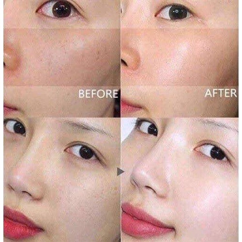 SERUM XỊT DƯỠNG TRẮNG DA MỜ NÁM Dongsung Miskos Whitening serum mist (mẫu mới)