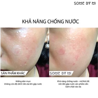 COMBO 2 Gói Dán Mụn Some By Mi Clear Spot Patch