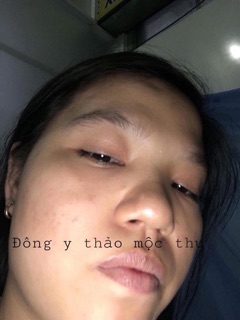 Đông Y Thảo Mộc Thu