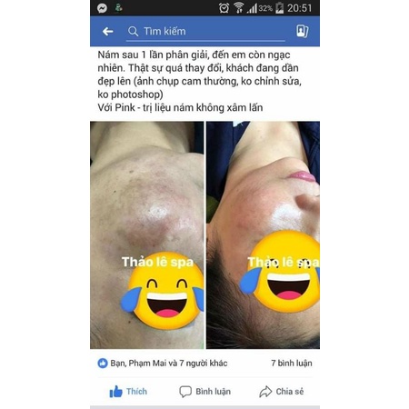 Bộ Sản Phẩm Kem Mờ Nám Da Pink Tulip, Cam Kết Sạch 80% Sau 2 Tháng