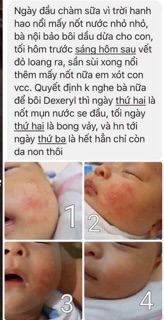 Kem nẻ Dexeryl Pháp 50gram